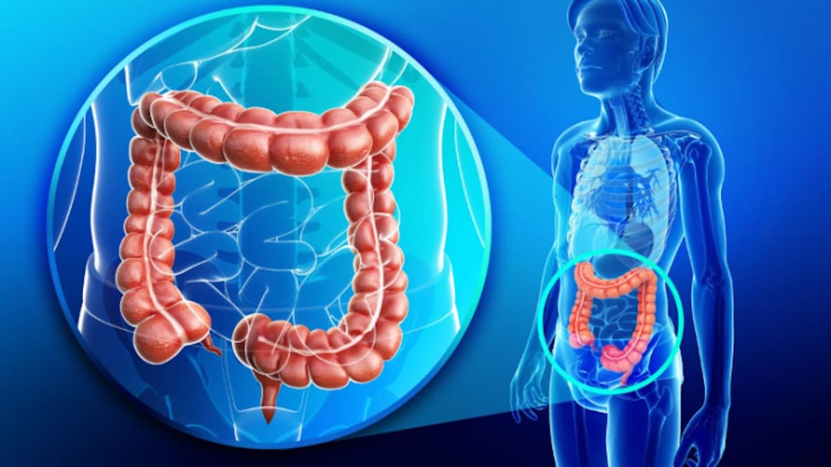 Dấu hiệu của bệnh táo bón nặng