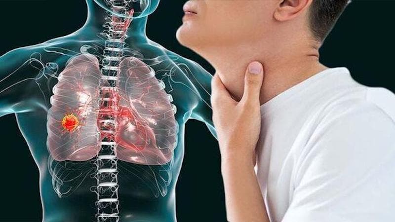 dấu hiệu bệnh phổi trắng ở người lớn