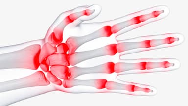 Đau khớp ngón tay là dấu hiệu bệnh gì?