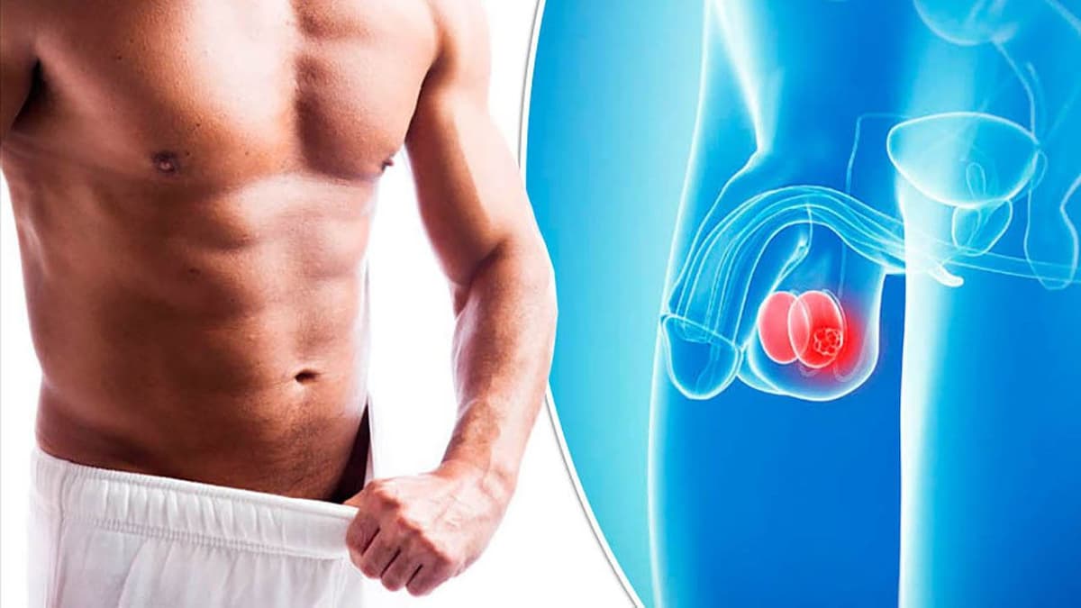 Đau tinh hoàn sau khi cương: Nguyên nhân và cách điều trị hiệu quả