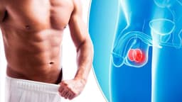 Đau tinh hoàn sau khi cương: Nguyên nhân và cách điều trị hiệu quả