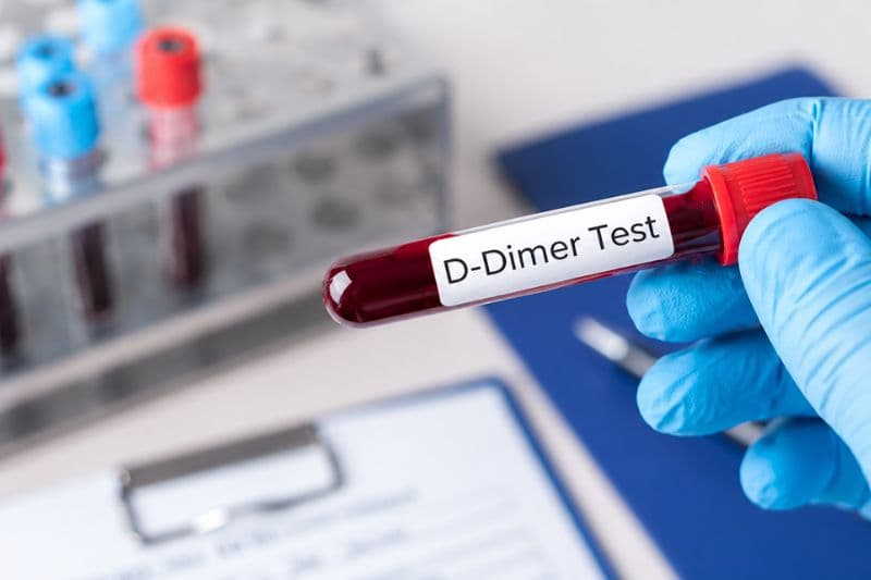 định lượng d dimer là gì