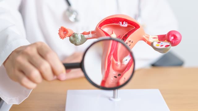 Thời gian và độ tuổi tầm soát ung thư cổ tử cung