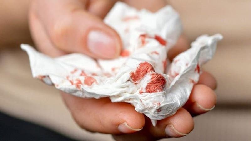 khạc ra máu là dấu hiệu bệnh gì