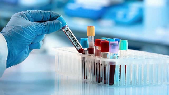 Địa chỉ khám sàng lọc ung thư uy tín tại Linh Đàm