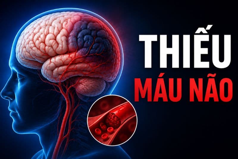 lý do thiếu máu lên não