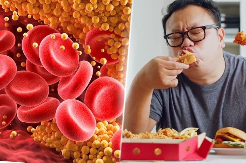 Các nguyên nhân đột quỵ ở người trẻ tuổi
