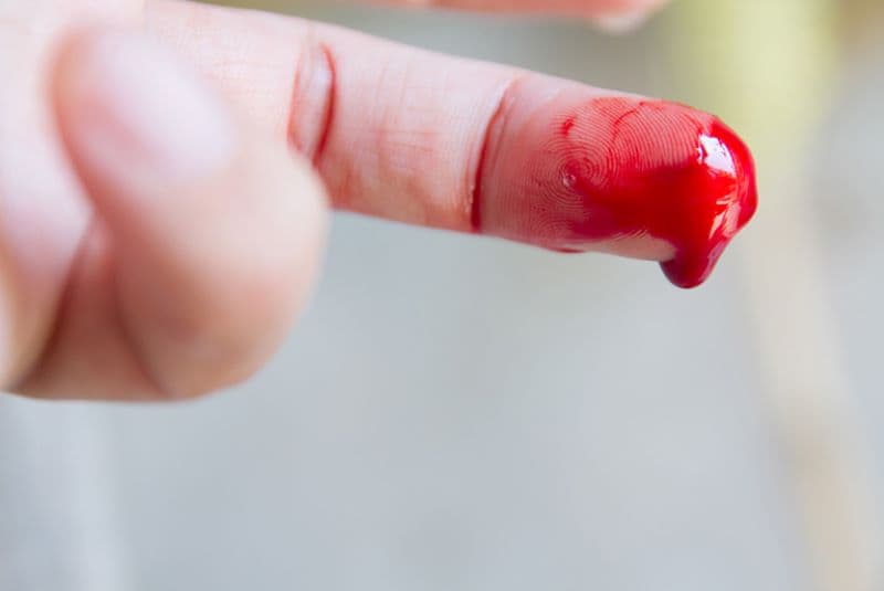 dấu hiệu bệnh máu khó đông