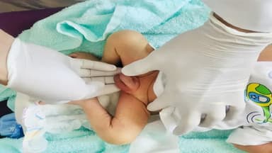 Nguyên nhân hẹp bao quy đầu và cách chữa trị hiệu quả cho trẻ