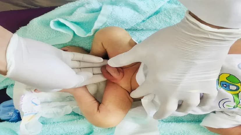 Nguyên nhân hẹp bao quy đầu và cách chữa trị hiệu quả cho trẻ