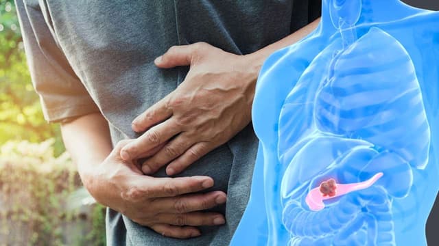 Tìm hiểu các nguyên nhân ung thư tụy