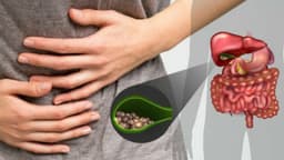Nhịn ăn sáng có bị sỏi mật không và vì sao?