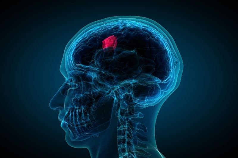 Hay bị đau đầu vùng trán và thái dương nguyên nhân do đâu?