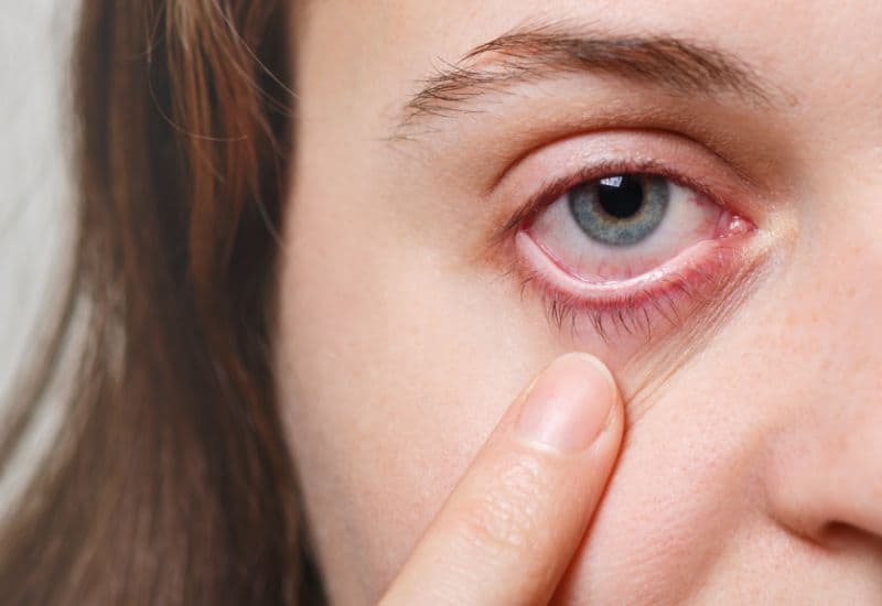 nước mắt nhân tạo khác gì thuốc nhỏ mắt