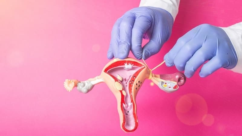 Phụ nữ có nên triệt sản không? Có tác dụng phụ nào không?