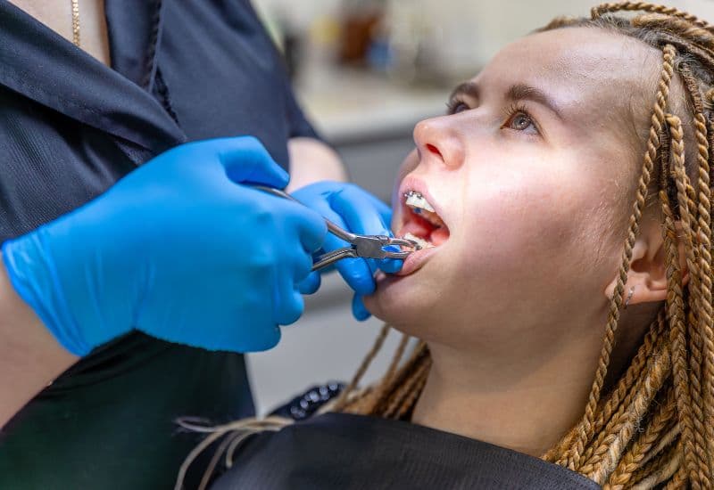răng sâu nặng có niềng được không