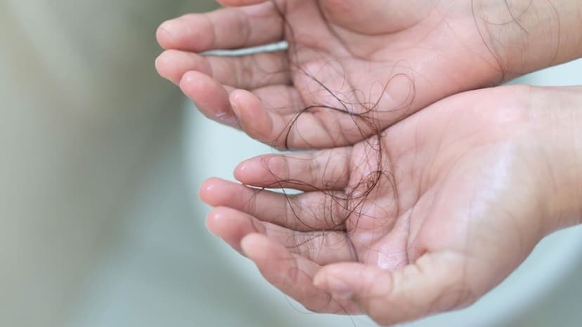 Rụng tóc nhiều là dấu hiệu bệnh gì?