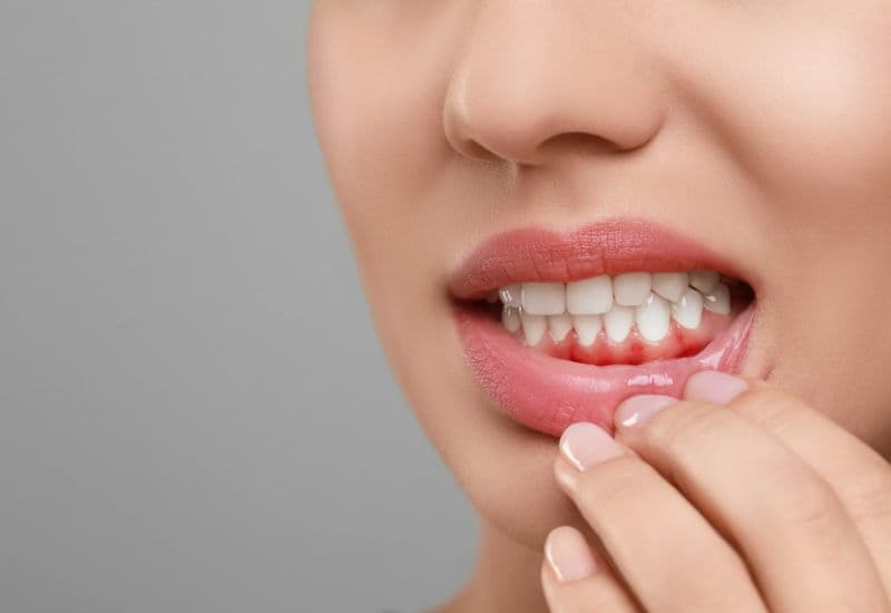 sau khi lấy cao răng bao lâu thì được ăn