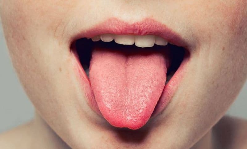 Bác sĩ giỏi chữa sùi mào gà