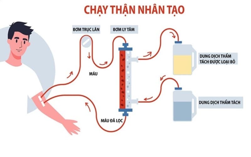 suy thận mức độ 3 có nguy hiểm không