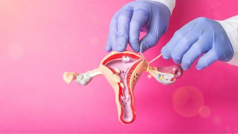 Thắt ống dẫn trứng có ưu nhược điểm gì?       