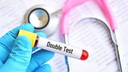 Xét nghiệm Double Test phát hiện bệnh gì?