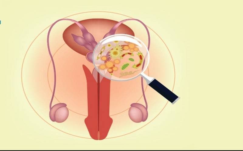 thuốc trị viêm tuyến tiền liệt