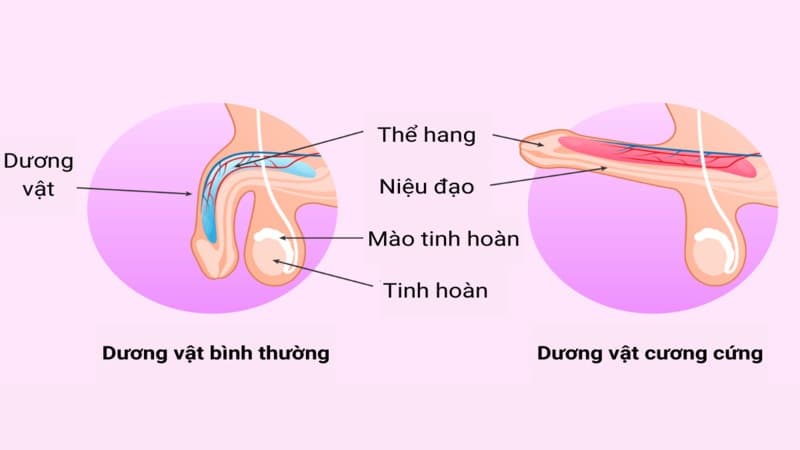 đau tinh hoàn sau khi cương