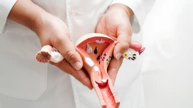 Sau triệt sản nữ có kinh nguyệt không?
