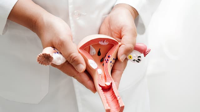 Sau triệt sản nữ có kinh nguyệt không?