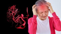 Dấu hiệu và nguyên nhân gây túi phình mạch máu não