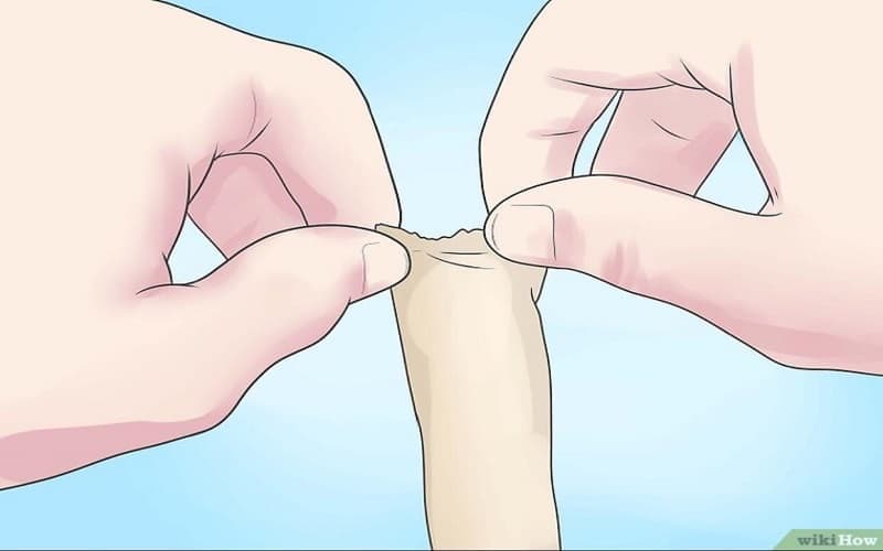 lột bao quy đầu là gì