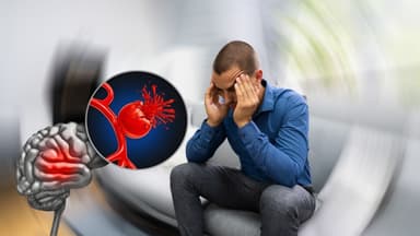 Vỡ túi phình mạch máu não nguy hiểm thế nào?