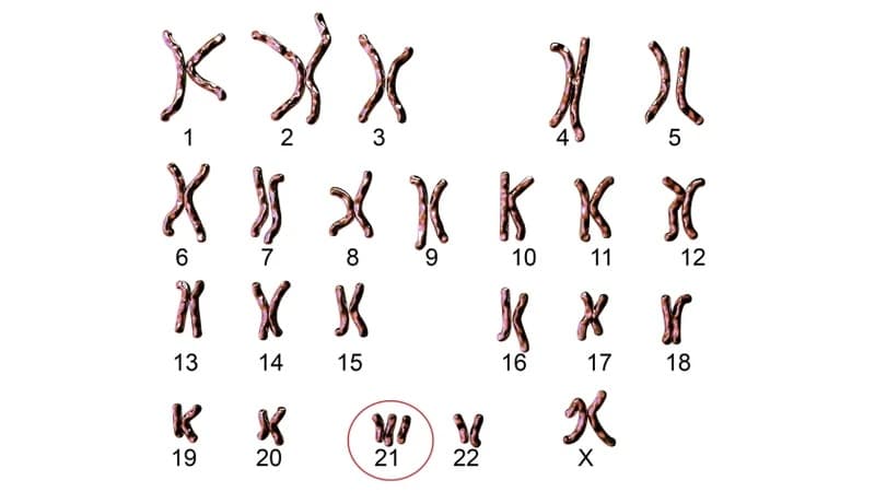 xét nghiệm double test phát hiện bệnh gì