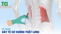 Gây tê cơ vuông thắt lưng: Giải pháp giảm đau hiệu quả, an toàn cho mọi phẫu thuật