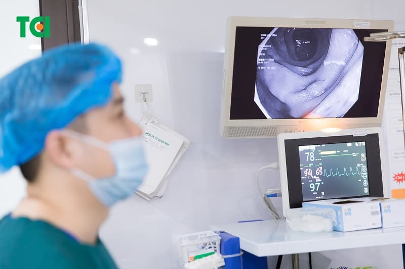 dấu hiệu ung thư đại tràng giai đoạn 0