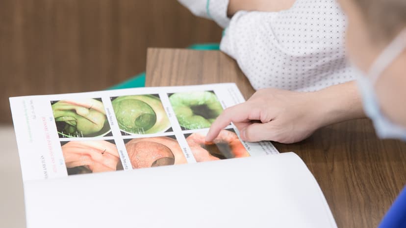 Dấu hiệu ung thư đại tràng giai đoạn 0
