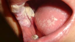 Mách bạn các bác sĩ giỏi chữa bệnh lậu ở Hoàng Mai được nhiều người đánh giá cao