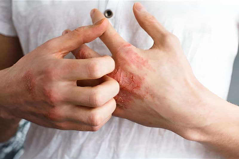 Danh sách bác sĩ giỏi chữa giang mai ở Thu Cúc cơ sở Linh Đàm 