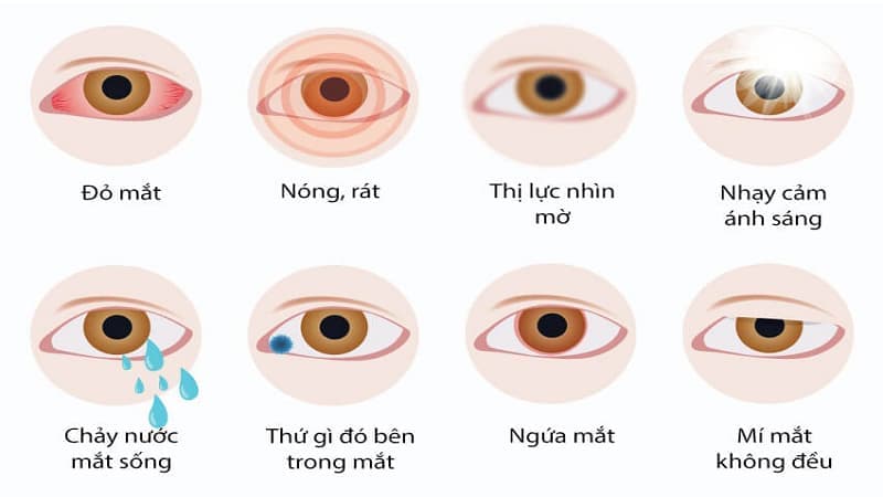 bác sĩ mắt giỏi ở Tây Mỗ