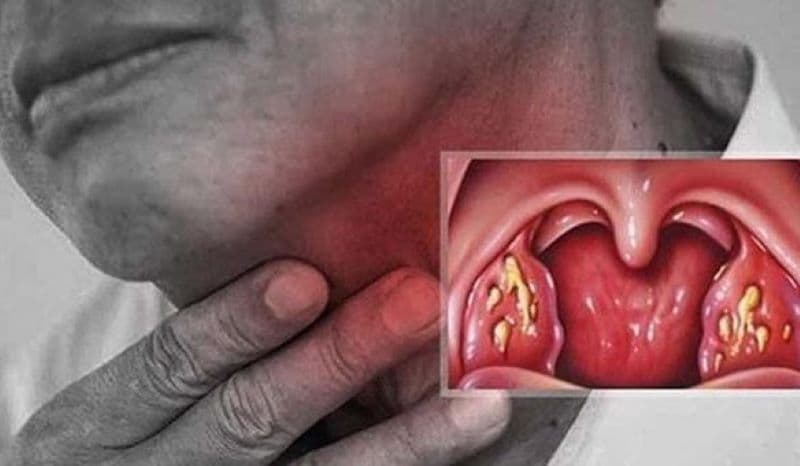 bác sĩ tai mũi họng giỏi
