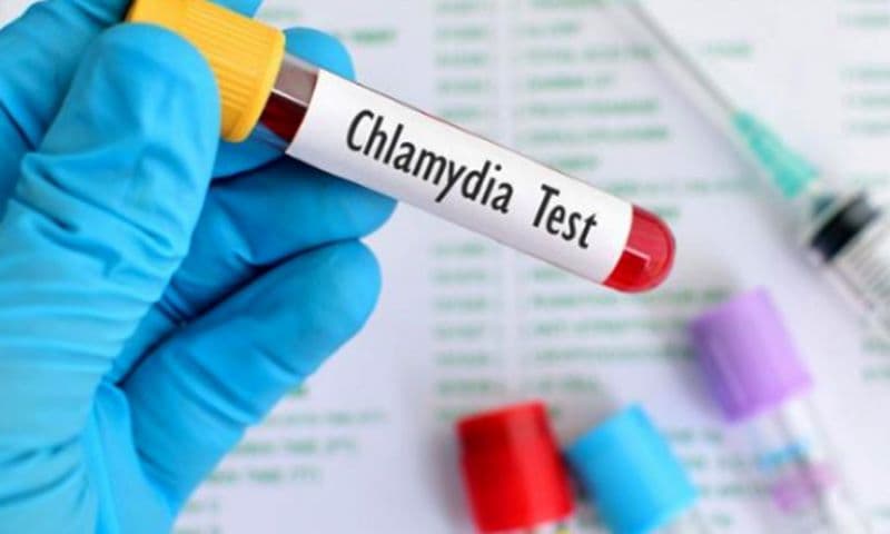 Bác sĩ giỏi chữa chlamydia