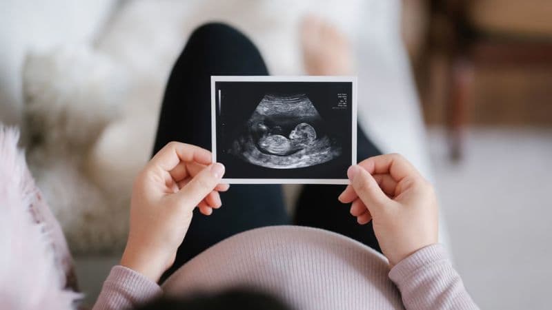chu vi vòng bụng thai nhi 26 tuần