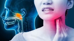 Dấu hiệu ung thư vòm họng nữ
