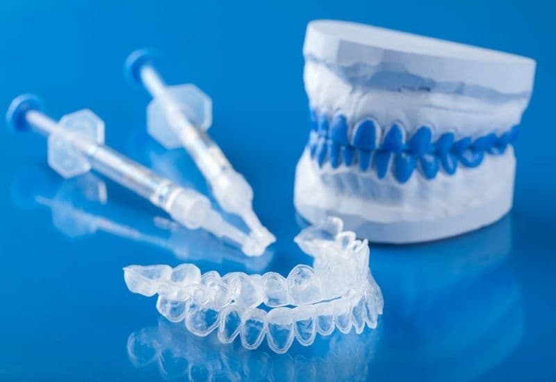 điều trị viêm lợi bằng máng