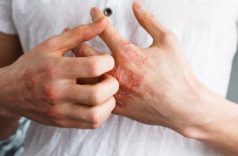 Cập nhật danh sách bác sĩ giỏi chữa giang mai ở TCI Thanh Trì