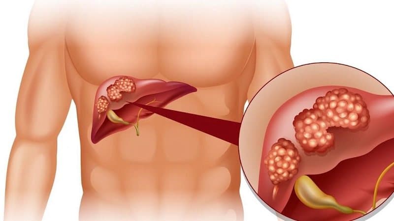 chất chống oxy hóa glutathione