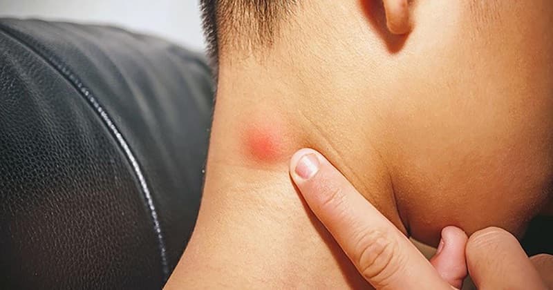 dấu hiệu ung thư tuyến giáp ở nam