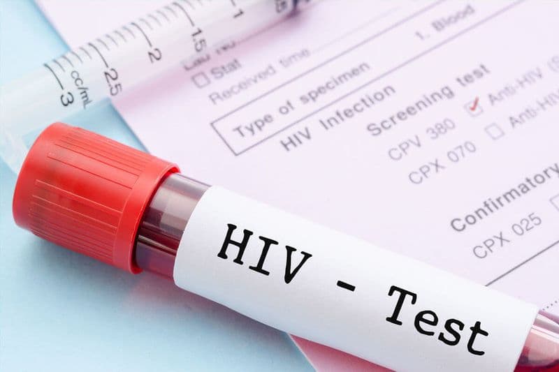 khám HIV