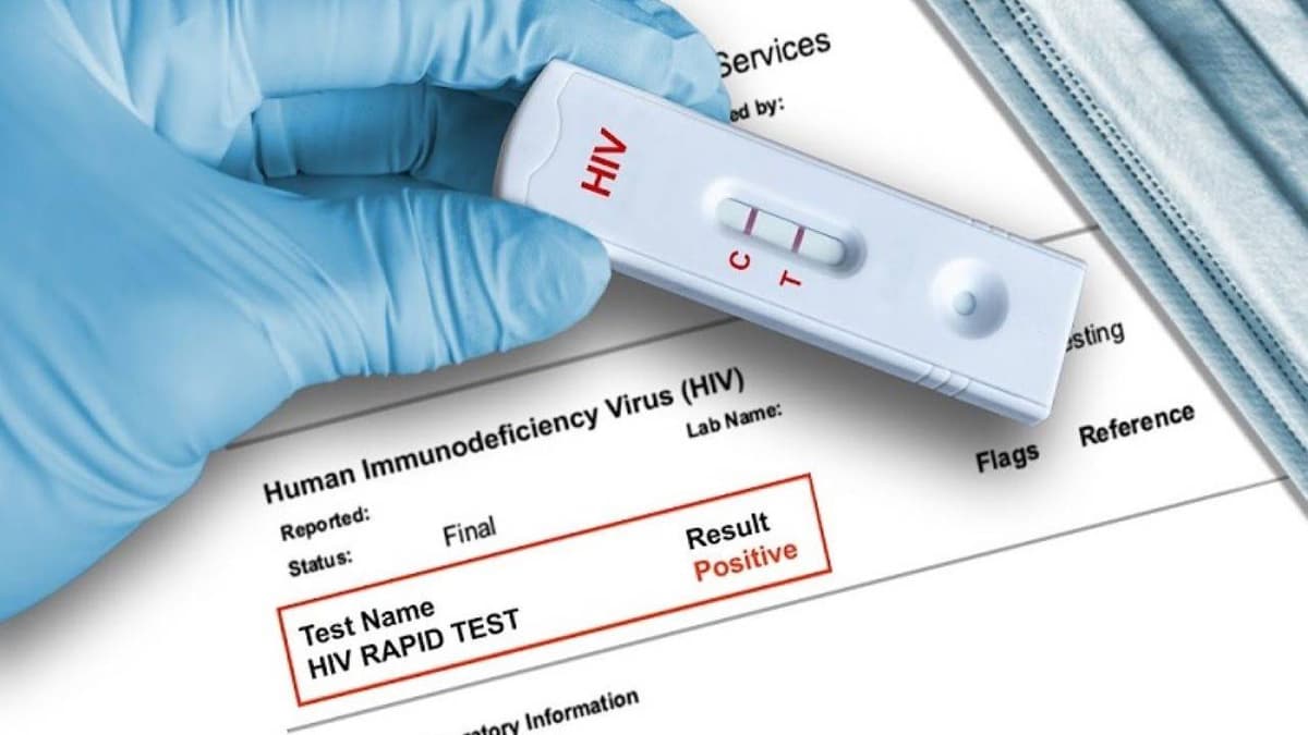 Nên khám HIV AIDS ở Thanh Trì tại đâu để đảm bảo chính xác và riêng tư?